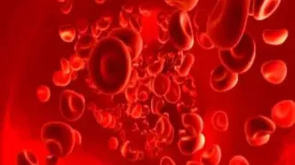 بررسی علت کم‌خونی فقر آهن در مردان و زنان یائسه ضروری است