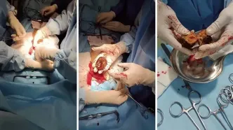 هشدار جدی برای شب یلدا / این میوه را همراه انار نخورید