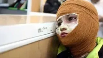 قیمت لباس سوختگی ۲ تا ۴۰ میلیون تومان