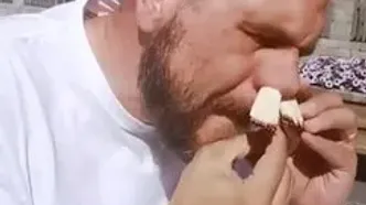 ثبت رکوردی عجیب در گینس؛ فرو کردن ۸۱ چوب کبریت در بینی