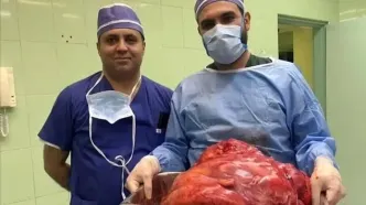 خارج کردن توده ۲۳ کیلویی از شکم خانم تبریزی