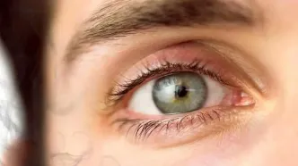 دود دخانیات بر چشم انسان چه تاثیری میگذارند؟