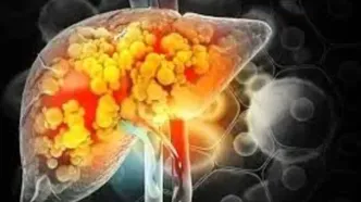 نوشیدنی هاو خوراکی های مناسب در وعده صبحانه برای کبد چرب