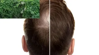 این گیاه می‌تواند کلید رشد مجدد مو باشد