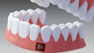 برچسب هوشمندی که التهاب لثه را تشخیص می دهد