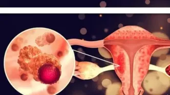 یک جراحی ساده که خطر سرطان تخمدان را تا ۸۰ درصد کاهش می‌دهد