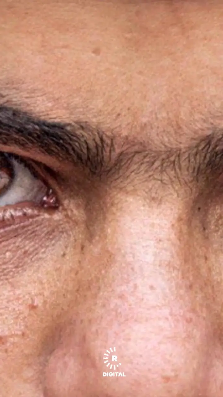 چشم‌های متفا‌وت جوان کُرد