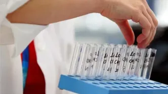 تست دوپینگ از ۲ بازیکن پرسپولیس و چادرملو