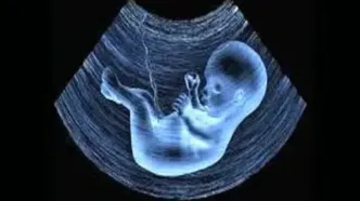 راه‌اندازی یک سامانه برای گزارش سقط جنین غیرقانونی