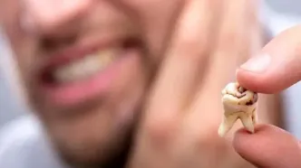 پنج اشتباه رایج در مراقبت از دندان‌ها