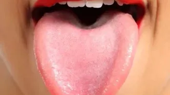 زبان؛ آینه‌ی تمام‌نمای سلامت بدن/ تشخیص بیماری‌ها از روی رنگ و بافت زبان