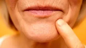 چرا لب‌‌ها با زیاد شدن سن نازک‌تر می‌شوند؟ راه‌حل آن چیست؟