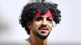 آثار کبودی در تمرین امروز پرسپولیس!