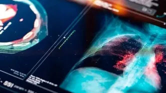 تشخیص سرطان ریه با یک آزمایش ساده روی ناخن‌ها