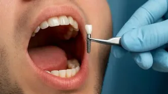 راهنمای جامع قیمت ایمپلنت دندان + نکات ضروری قبل از درمان