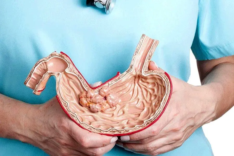 نسخه خانگی برای تقویت معده