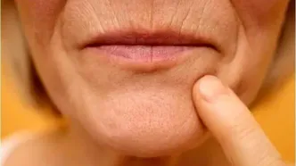 چرا لب‌ها با بالا رفتن سن نازک می‌شوند؟