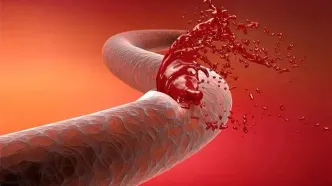 اقدامات فوری برای کنترل خونریزی هنگام جنگ