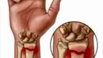 تاثیر مستقیم یائسگی بر استخوان