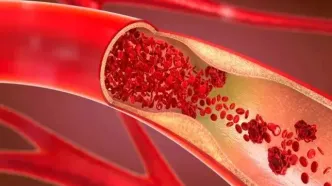 روش های اورژانسی پیشگیری از خونریزی در مجروحان