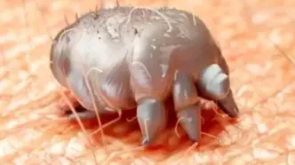 در مورد بیماری گال چه می دانید؟