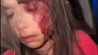 ویدیویی که علی ضیاء از یک دختر بچه آسیب دیده از حملات منتشر کرد