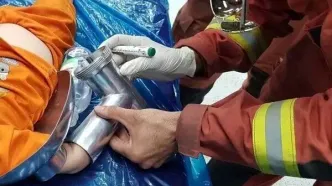 حادثه برای دست کودک دو ساله
