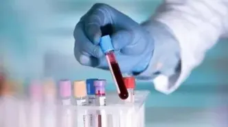 حذف یک آزمایش مهم از پوشش بیمه
