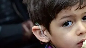 حمایت از درمان ۱۱ هزار کودک ناشنوا در مناطق کم‌برخوردار کشور