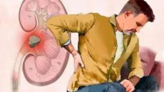 آیا مصرف کلسیم باعث سنگ کلیه می‌شود؟