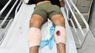 «ضارب دختران» از دو پا و دستی که آنان را کتک می‌زد، گلوله خورد + فیلم عذرخواهی متهم