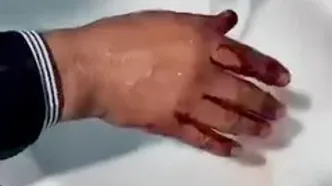 چرخه باطل دلسوزی و خشونت /پشت پرده غذارسانی ناآگاهانه به سگ‌ها  و ناکارآمدی شهرداری