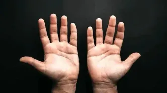 چرا پنج تا انگشت شبیه هم نیستند؟