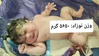 تولد نوزاد ۵ کیلو و ۶۵۰ گرمی در بیمارستان امام رضا(ع) کرمانشاه
