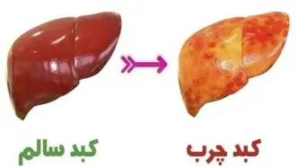 نوشیدنی‌های صبحگاهی برای کبد چرب