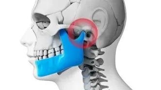 راهکارهای موثر در کاهش علایم و مشکلات مفصل فکی گیجگاهی