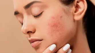 این اشتباهات لکه‌های صورت را بدتر می‌کنند؛ مراقب پوستتان باشید!