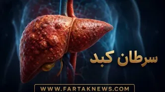 علائم سرطان کبد؛ از درد شکم تا زردی پوست و کاهش وزن