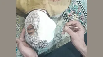 فیلم تکاندهنده از فرو رفتن میله فلزی در چشم دختر بچه در اردبیل