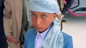 کودکی با چشمان جادویی که یک‌شبه مشهور شد