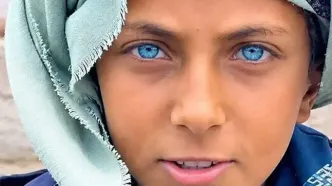چشمان جادویی این کودک او را یک‌شبه معروف کرد