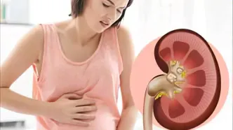 ویتامین C؛ دوست سرماخوردگی، دشمن کلیه‌ها