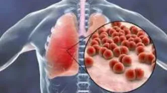 چگونه طاعون ریوی منتقل می‌شود؟