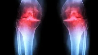 کدام خوراکی ها ممکن است درد و التهاب مفاصل را تشدید کنند؟