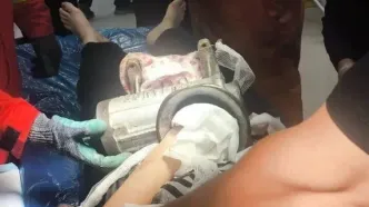 دست کارگر ۴۸ ساله در چرخ‌گوشت گیر کرد