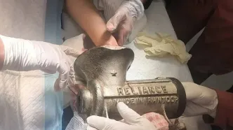 جراحت شدید دست زن کارگر در چرخ‌گوشت در مرکز تهران