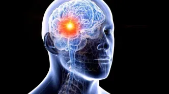 هوش مصنوعی جدید با تحلیل DNA می‌تواند ریسک سکته مغزی را پیش بینی کند