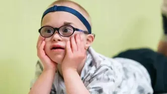 سندرم داون چیست؟ از علت کروموزوم اضافی تا علائم، تشخیص و آینده زندگی مبتلایان